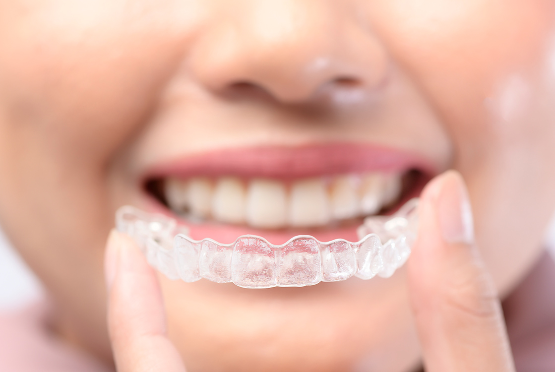 Diş Çarpıklığı Tedavisi